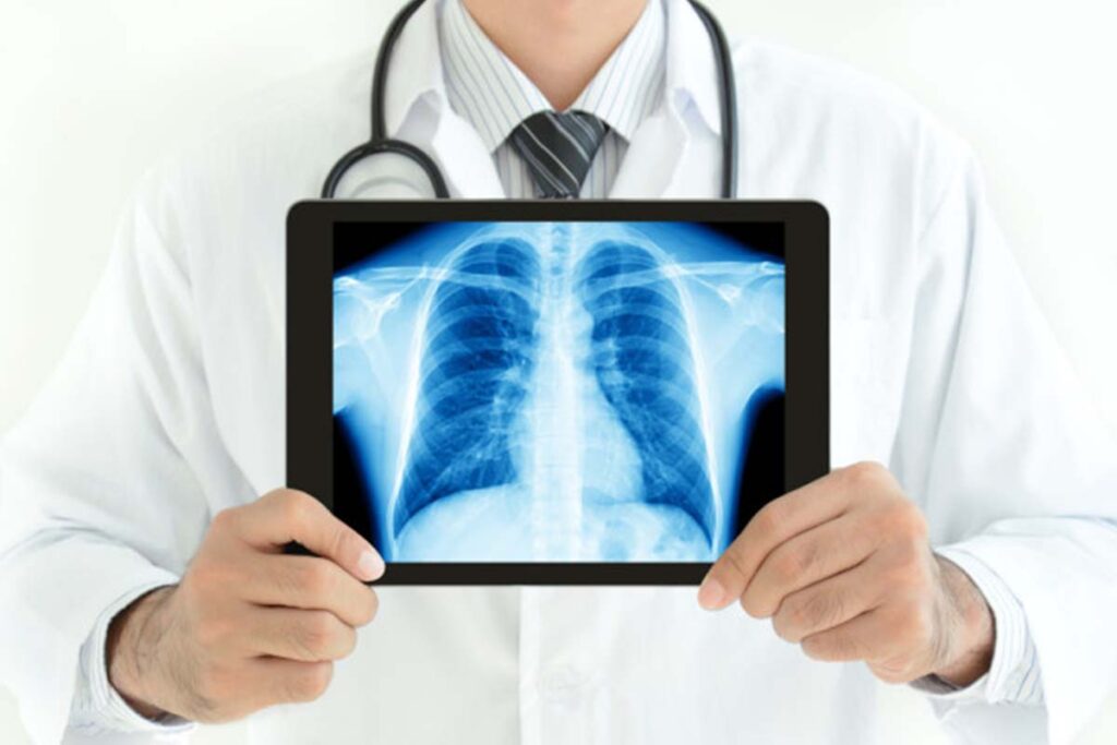 digital x ray